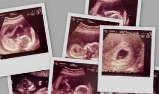 准备怀孕网 准备怀孕网